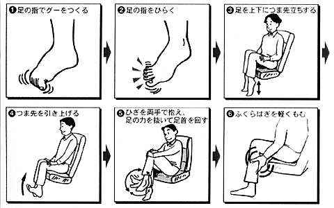 エコノミー クラス 症候群 症状